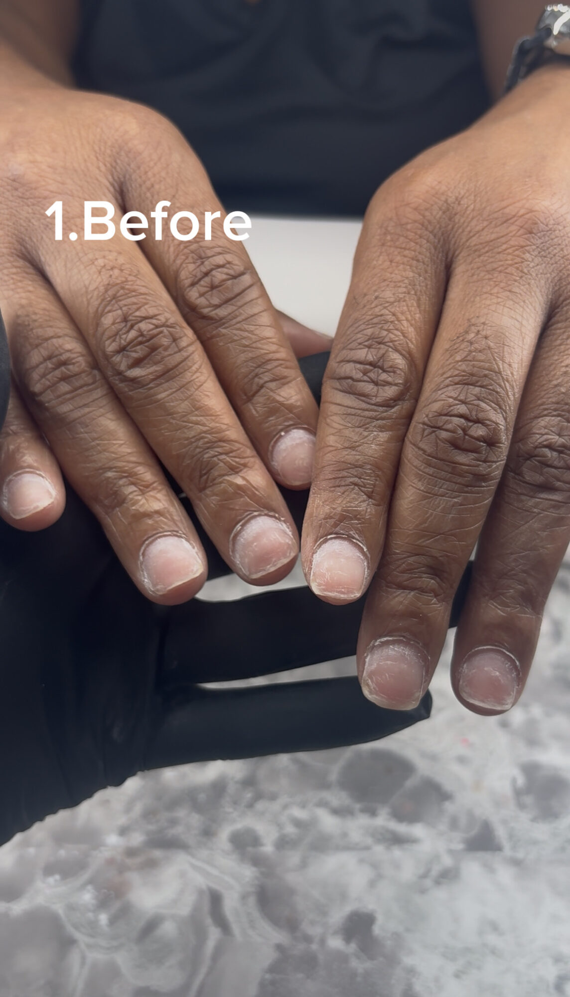 Close-up of two hands with fingers touching, showing nails and skin texture, on a reflective surface.