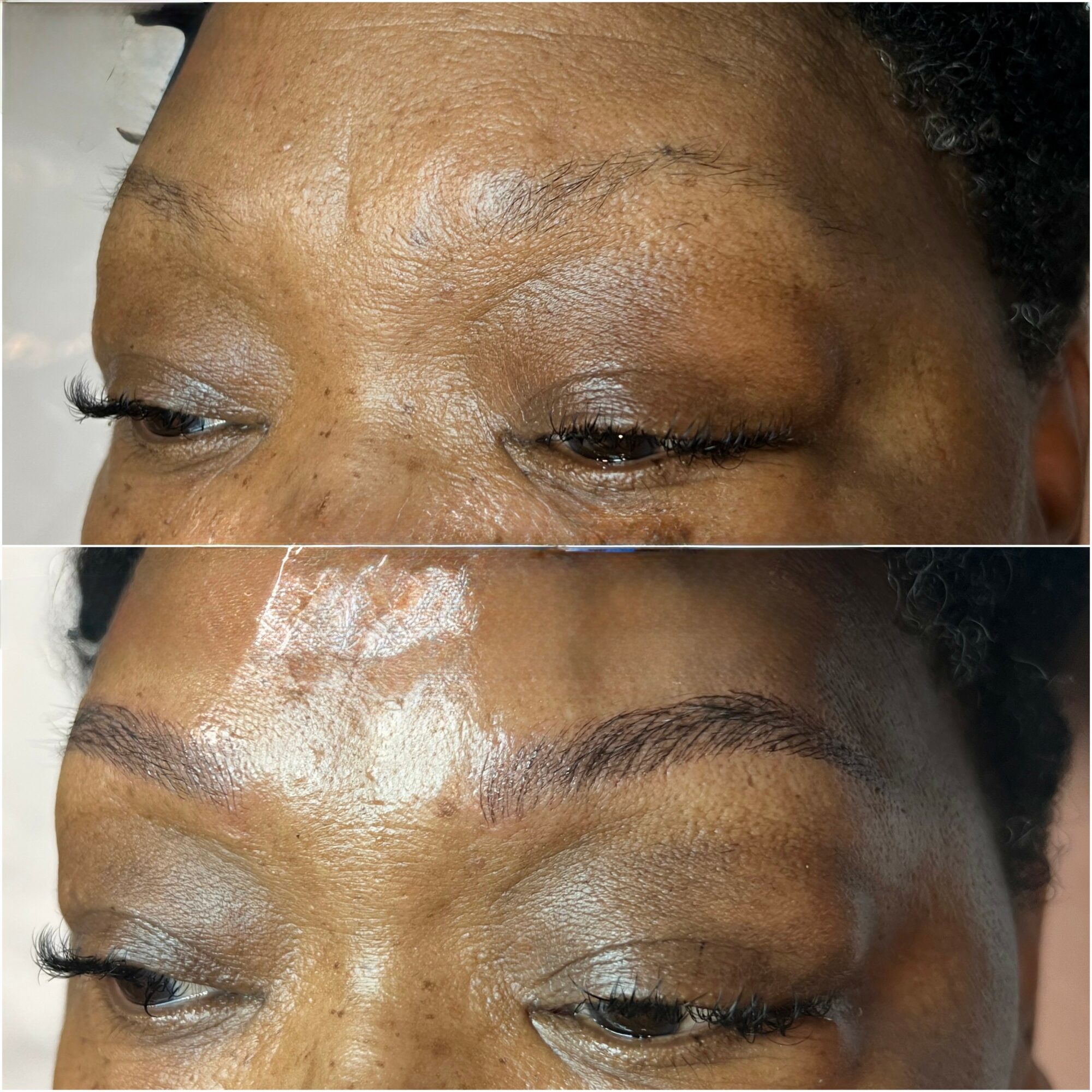 Close-up of a person's forehead and eyebrows before and after skincare treatment, showing improved skin texture and appearance.