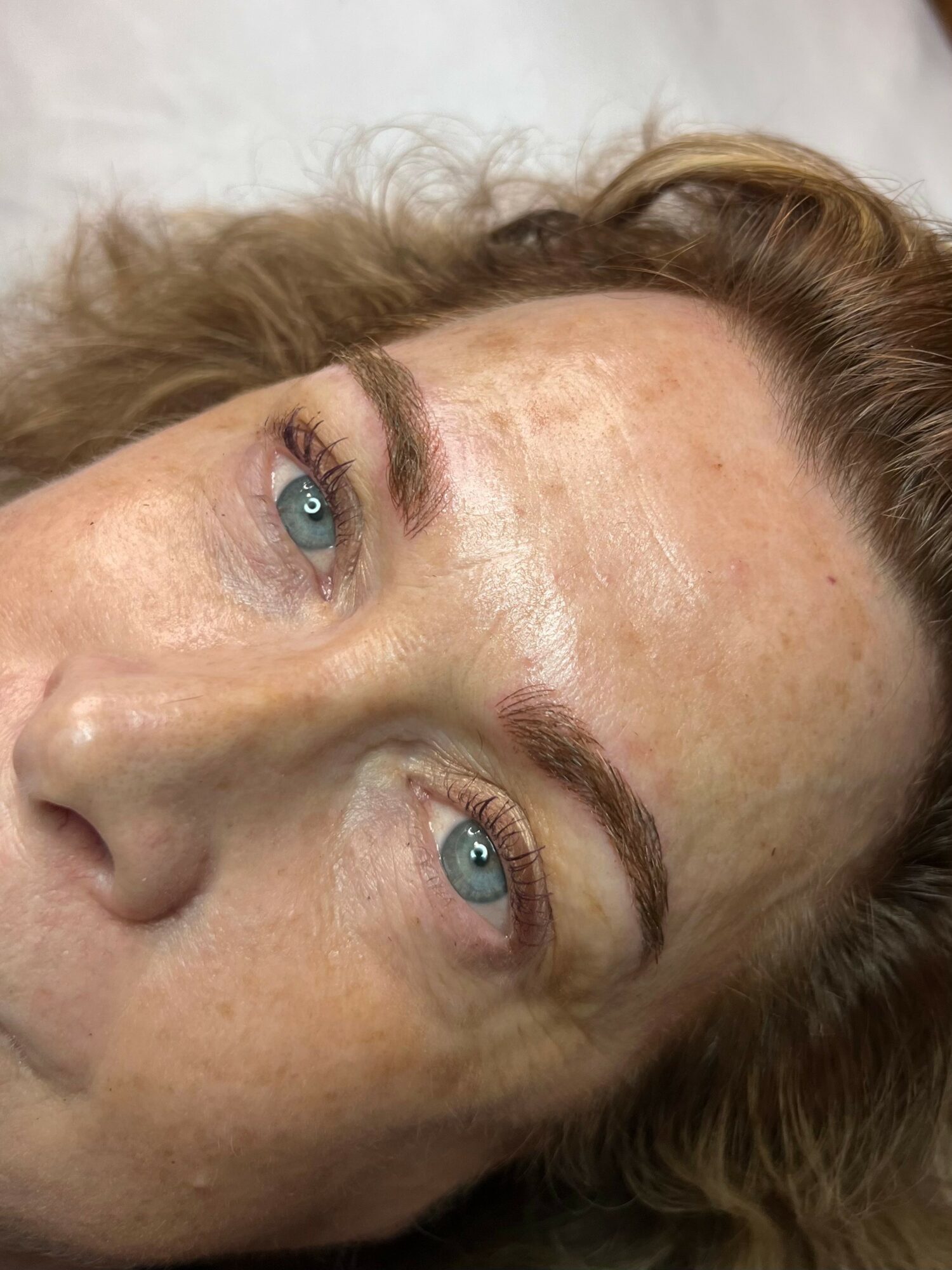 Close-up of a woman's face with blue eyes and light brown hair, lying down with visible skin blemishes.