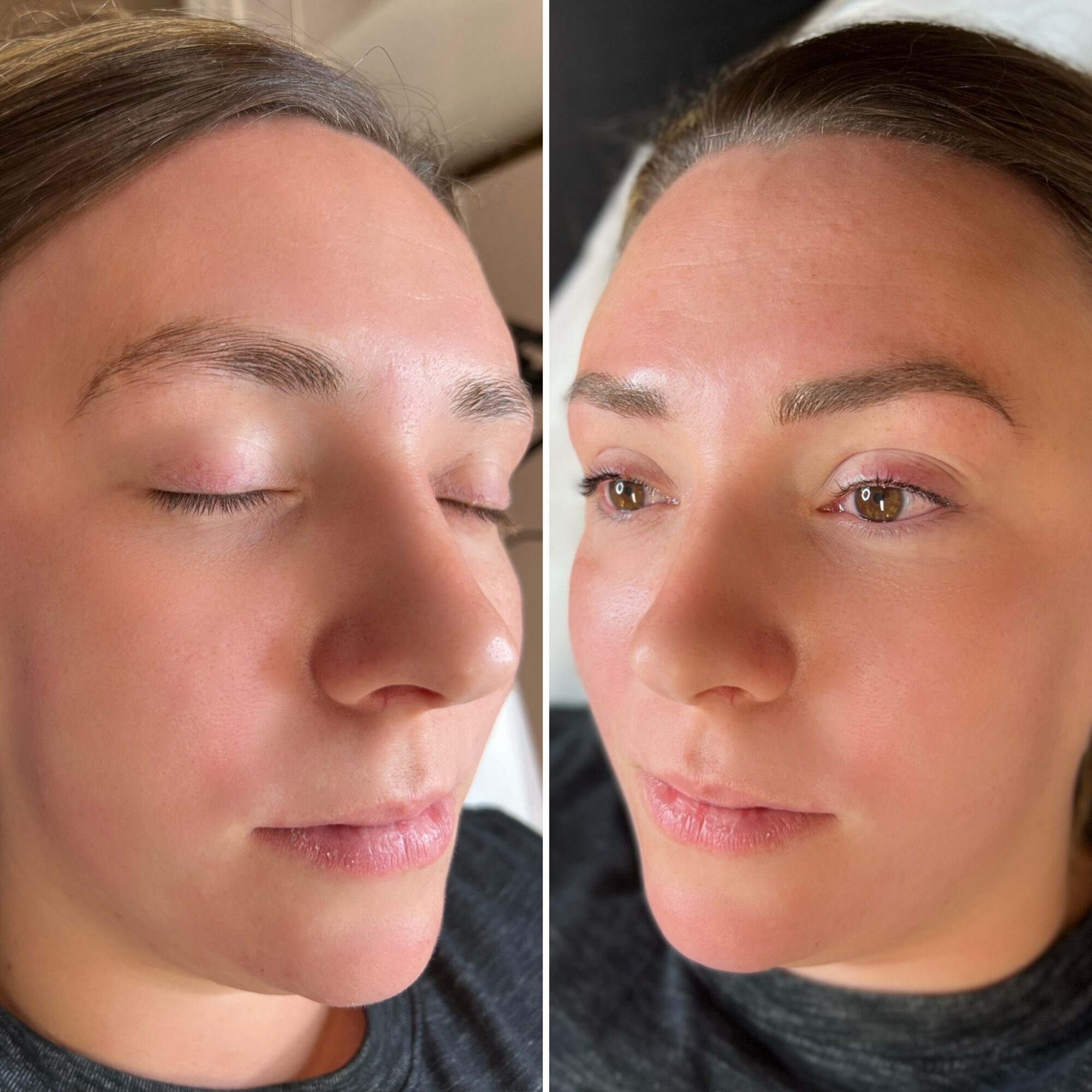 Side-by-side comparison of a woman's face, one with eyes closed and the other with eyes open, showing skin and facial features.