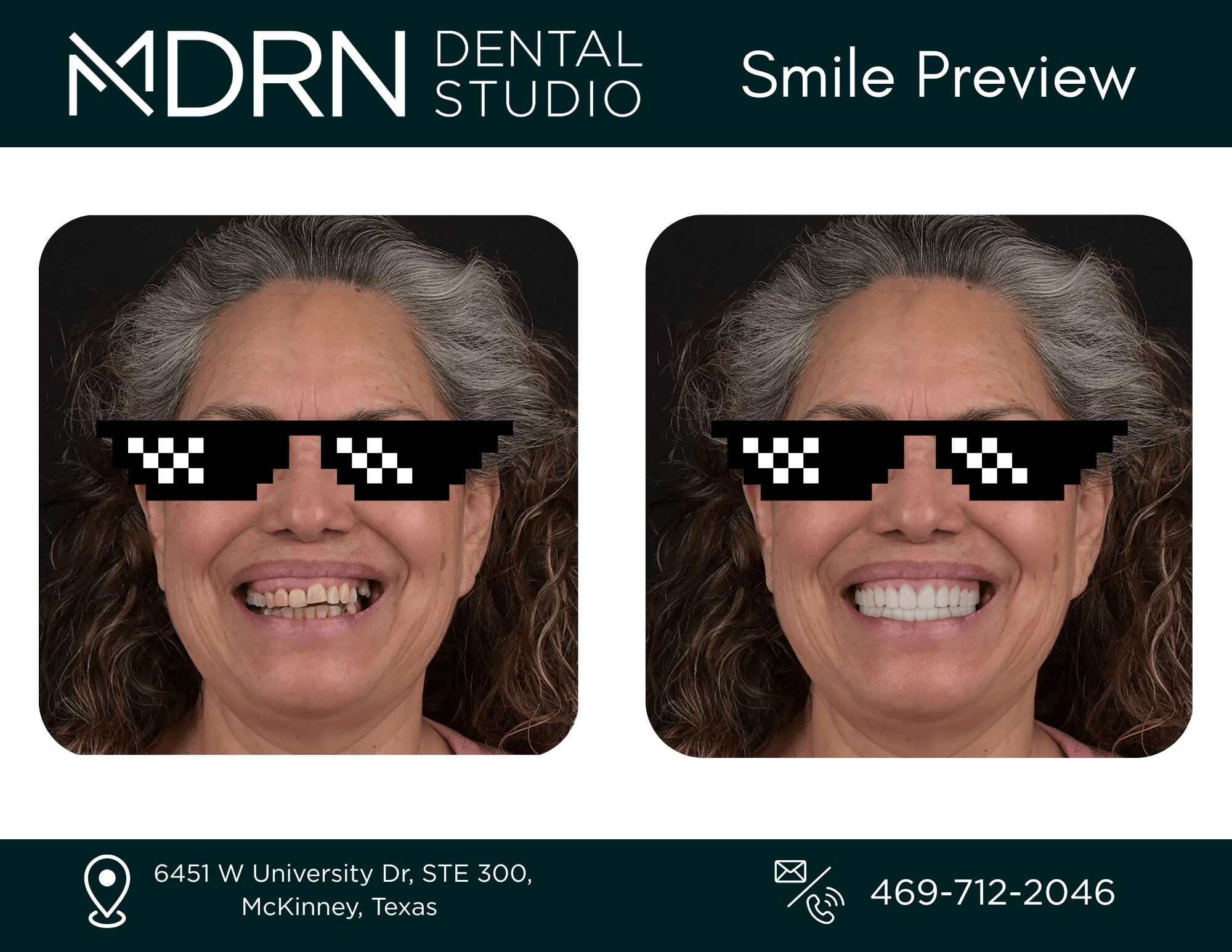 Side-by-side images of a woman with gray hair, smiling, wearing pixelated sunglasses, showing dental improvements, with clinic info below.