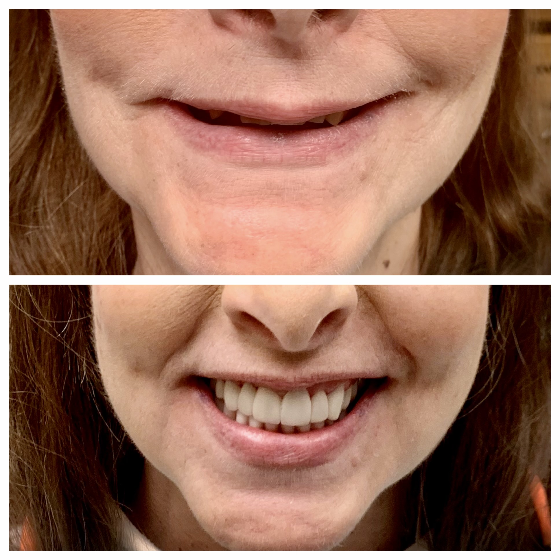 Close-up of a person's mouth showing teeth and a smile, with the upper image upside down. Word count: 20