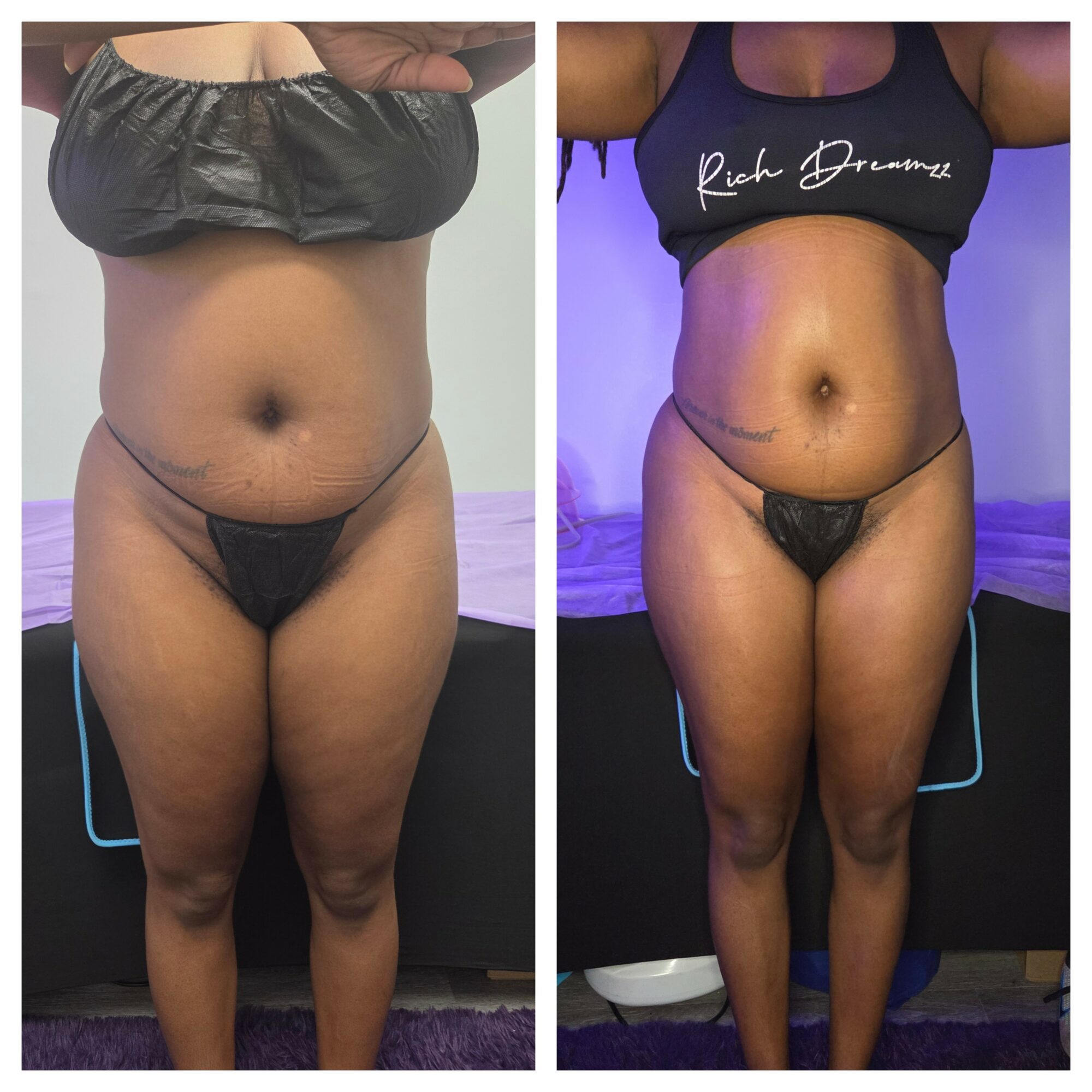 Before and after images of a woman showing body transformation, wearing black clothing, standing in front of a purple-lit background.