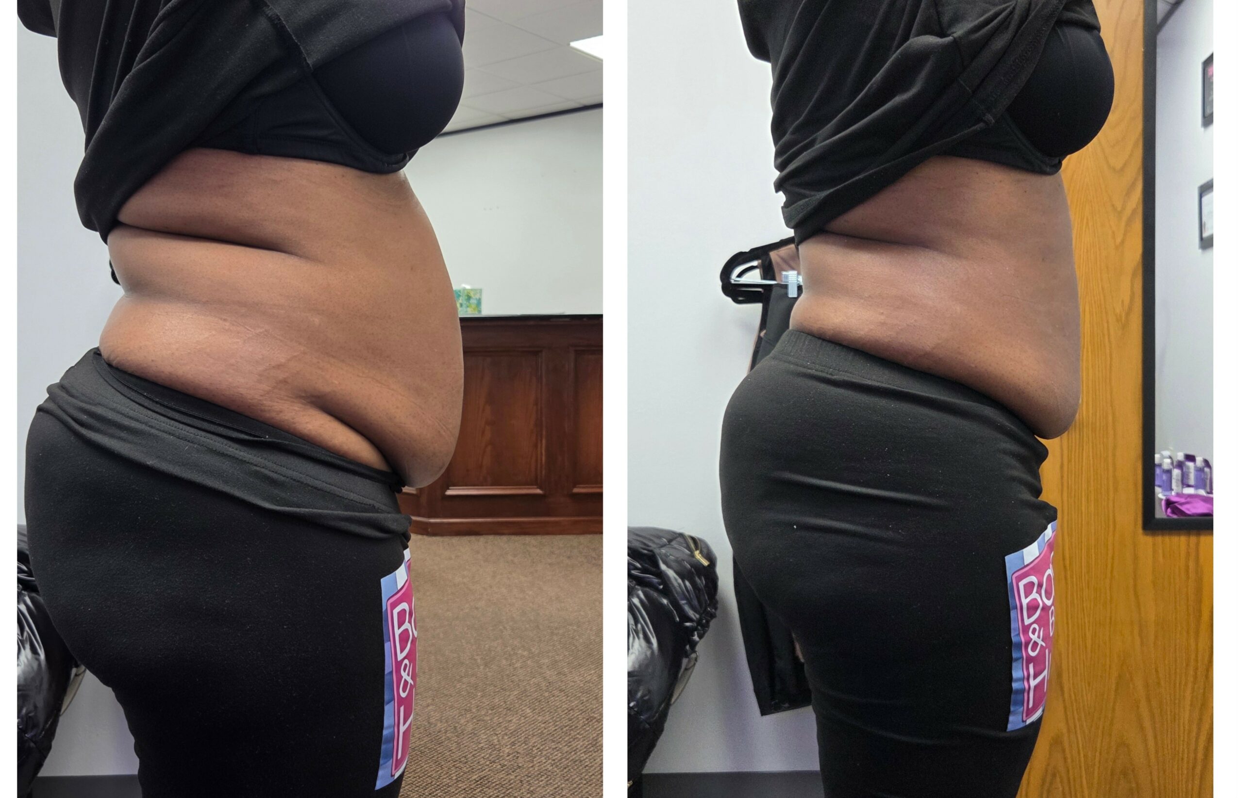 Side view of a person showing abdominal and waist area before and after weight loss, wearing black clothing.