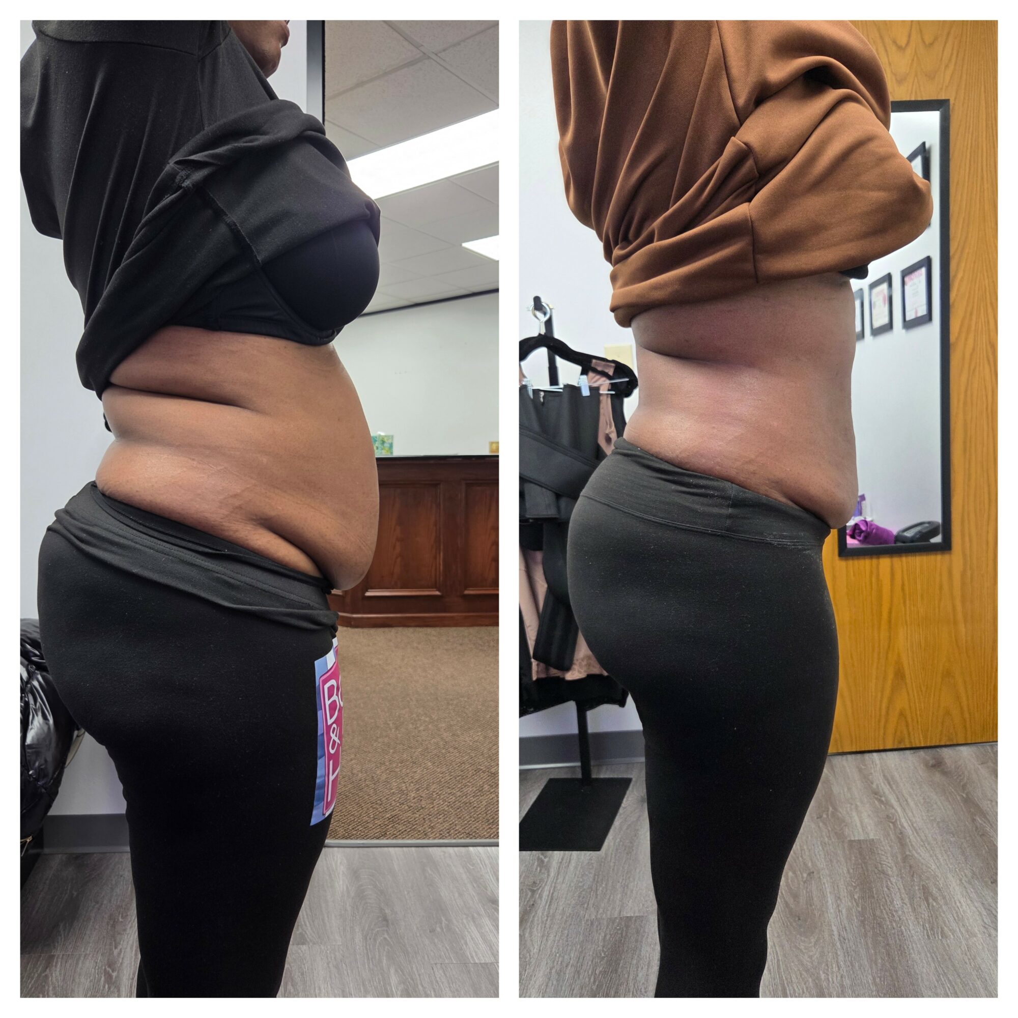Side view of a person before and after weight loss, showing reduced abdominal size and waistline, wearing black pants and a top.
