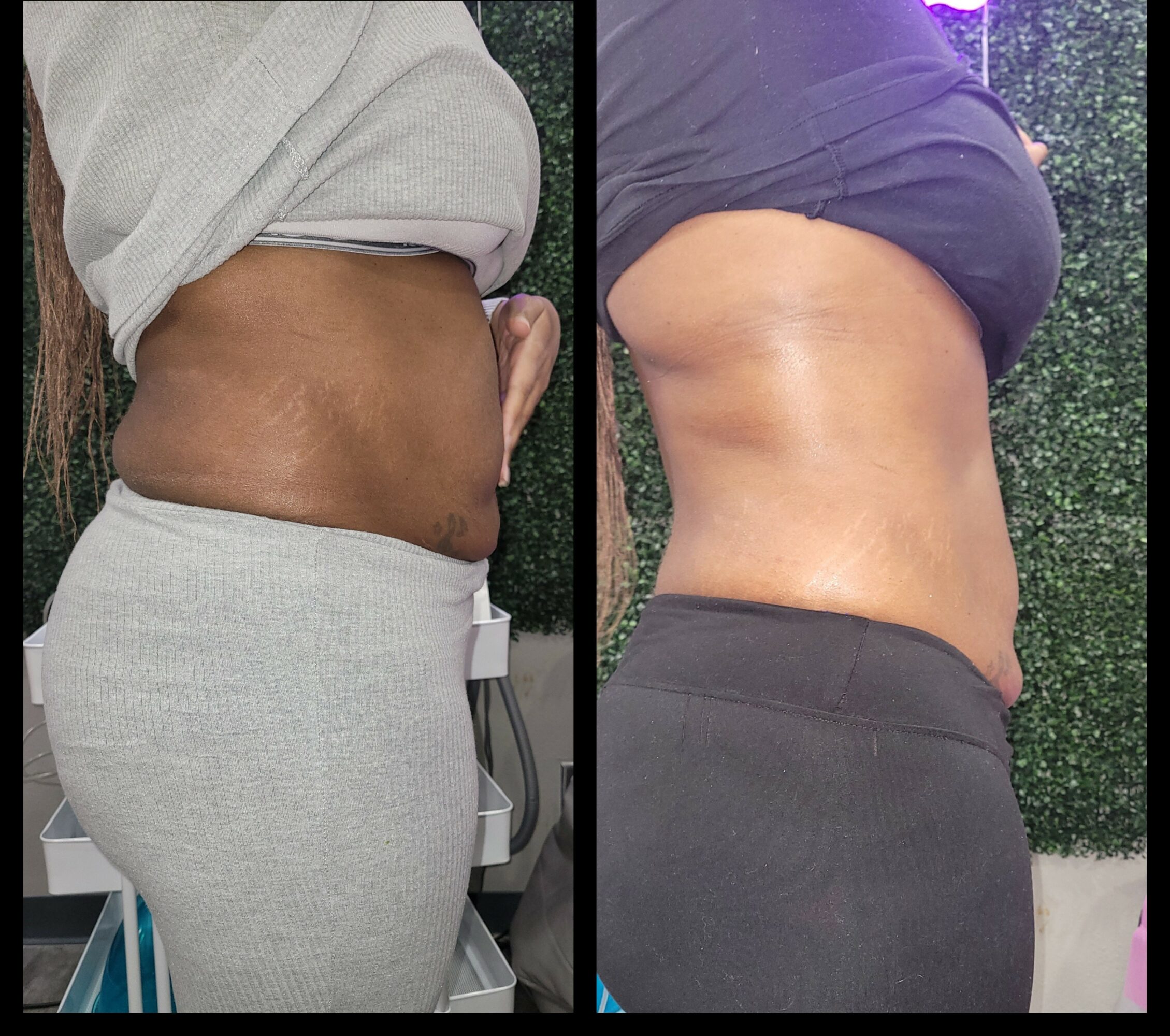 Side-by-side comparison of a person's torso before and after weight loss, showing a slimmer waist in the second image.