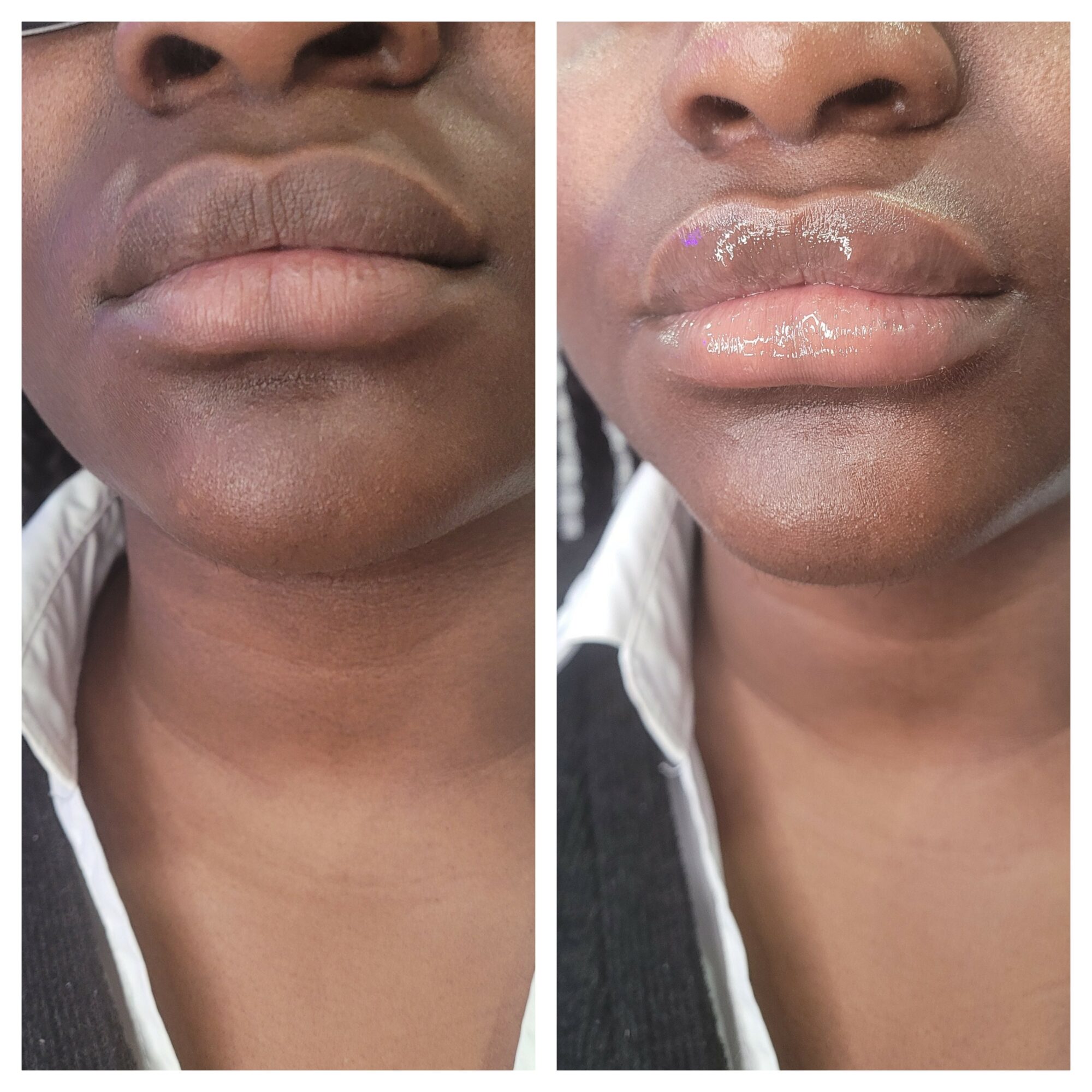 Side-by-side images of lips before and after lip gloss application, showing increased shine and fullness in the second image.