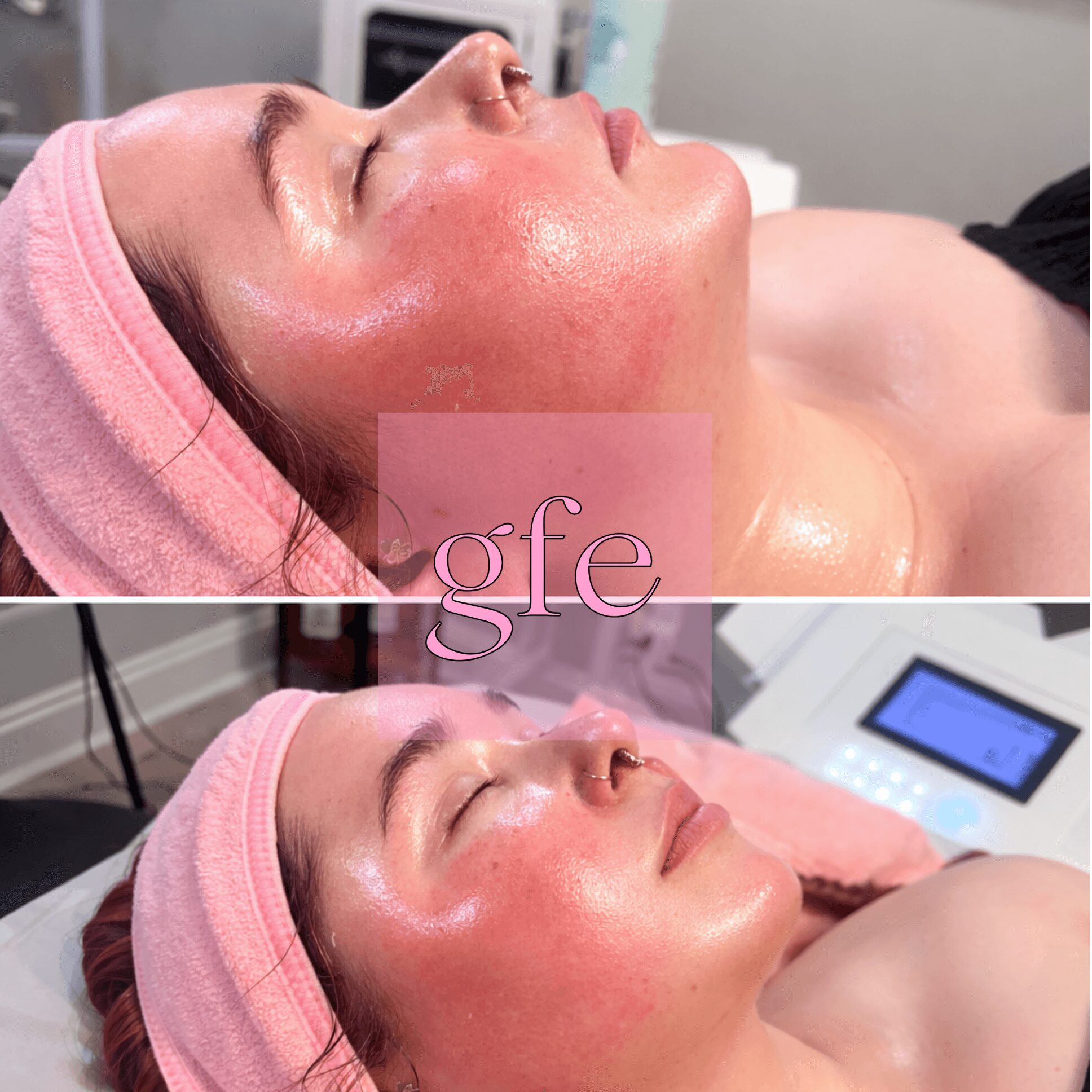 Woman with pink headband receiving facial treatment, face glowing, eyes closed, in a clinical setting.