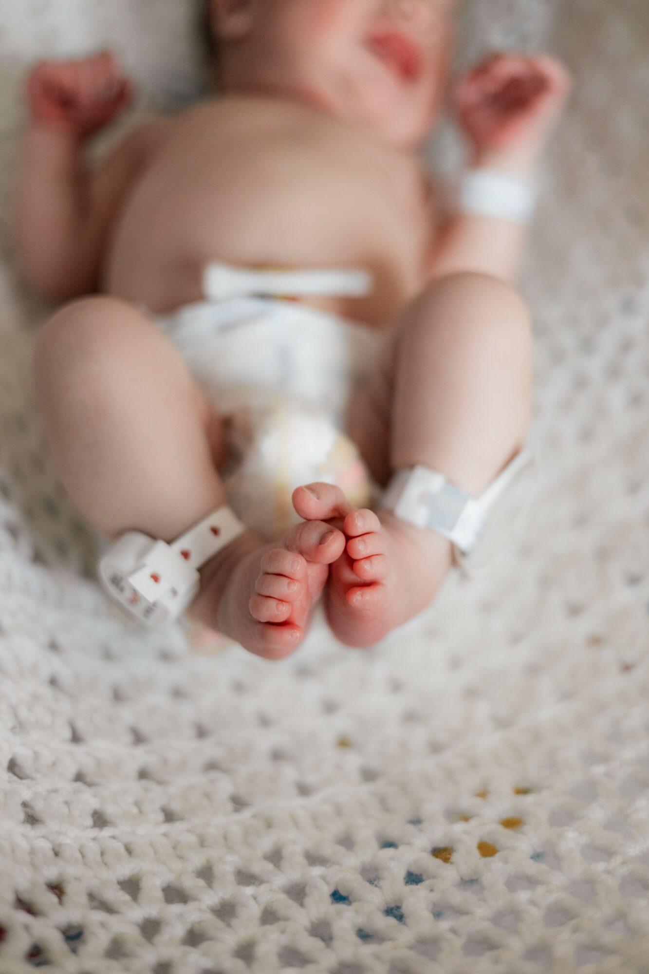 Newborn baby lying on a blanket with medical wristbands, feet close together, and arms raised.