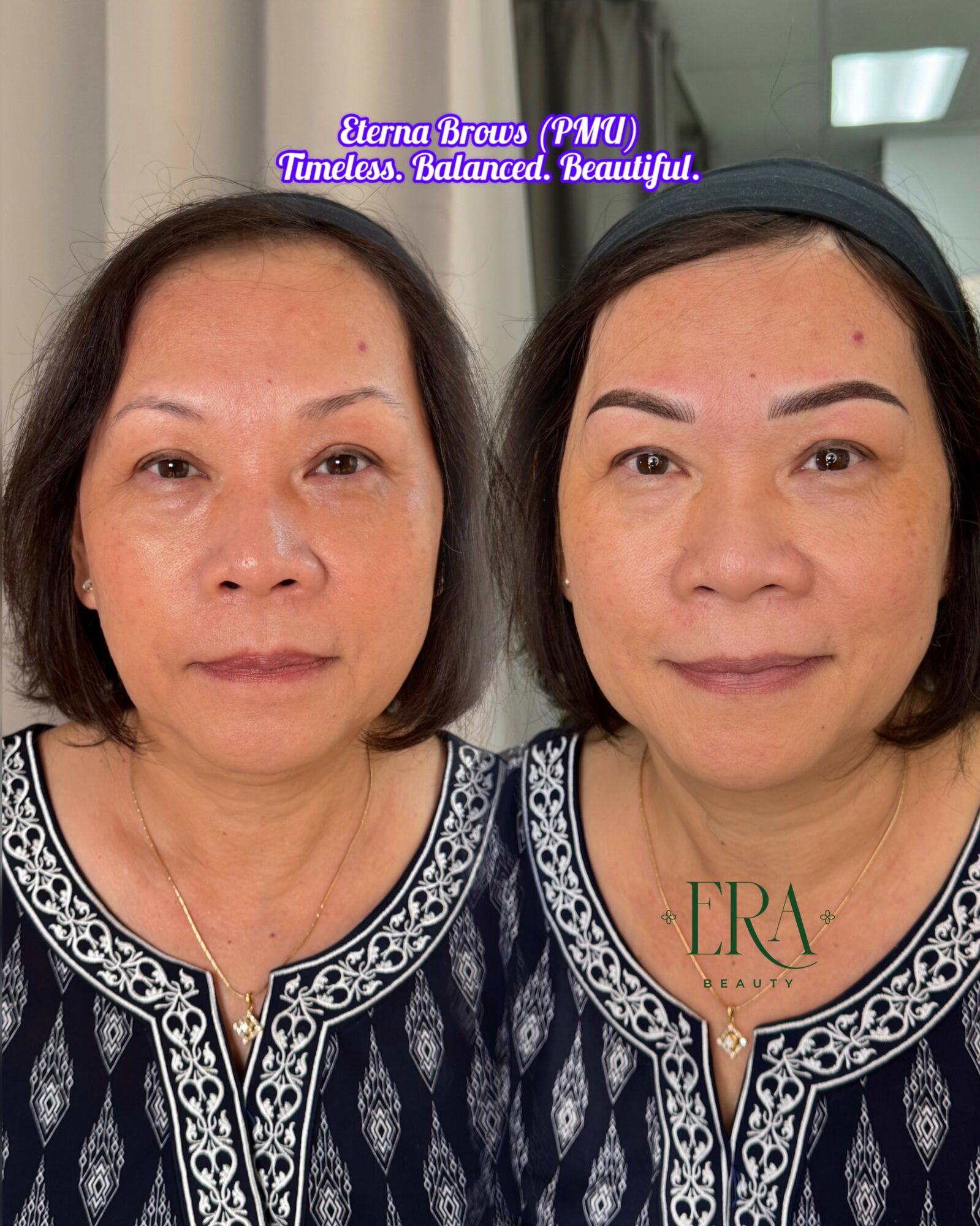 Side-by-side images of a woman before and after skincare, with text indicating improvement, in a well-lit room.