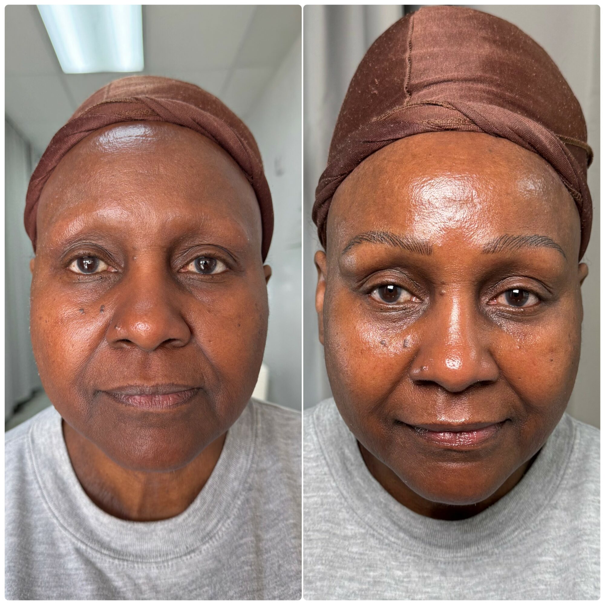 Before and after skincare treatment, woman with headscarf, showing improved skin texture and glow, neutral expression, gray shirt, indoor setting.