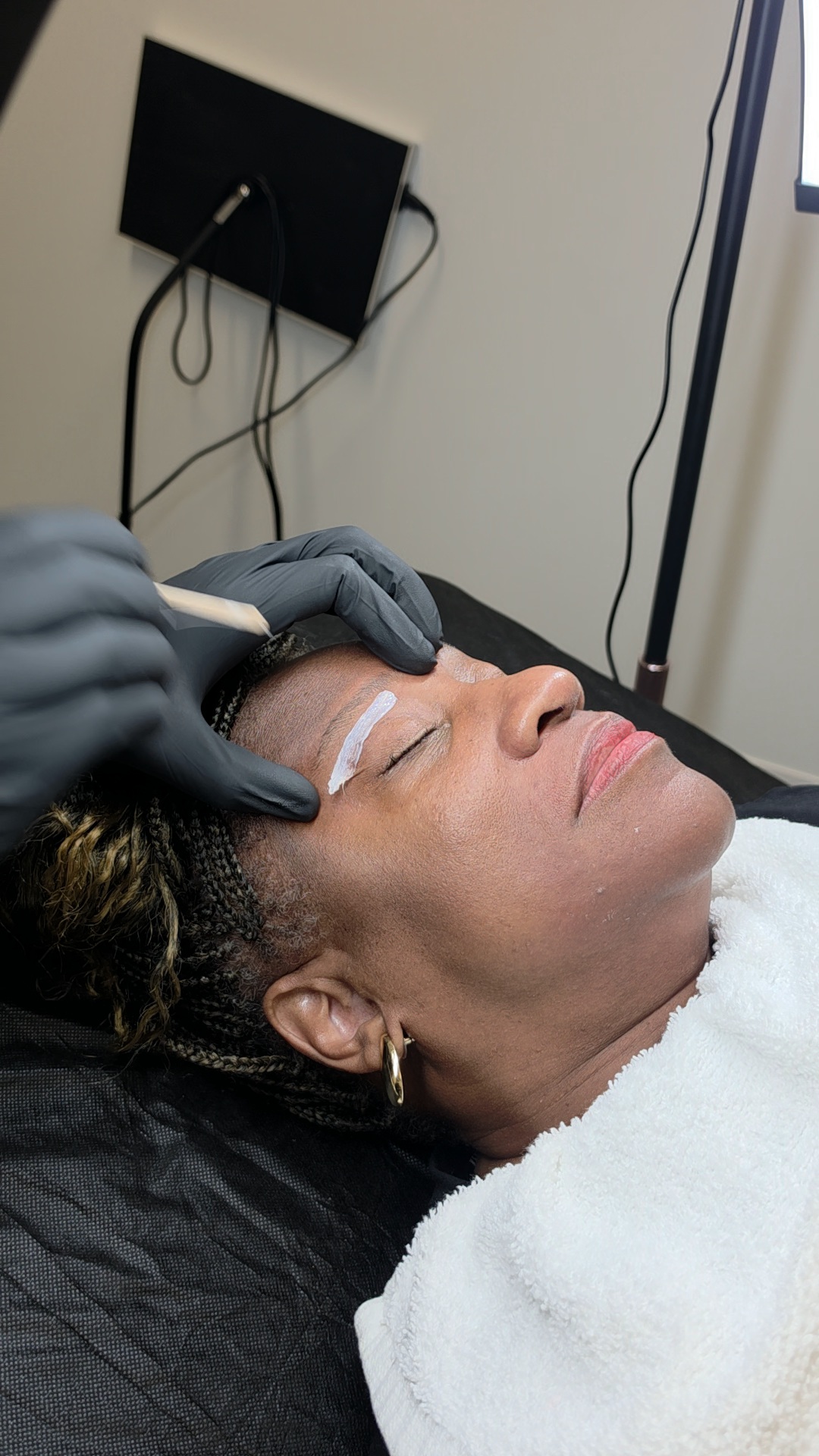 Person receiving a cosmetic procedure on their eyebrow while lying down with eyes closed, in a clinical setting.