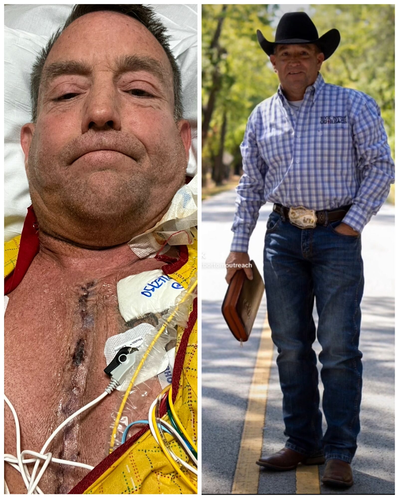 Side-by-side images of a man in a hospital bed and a man in cowboy attire outdoors, both appearing middle-aged.